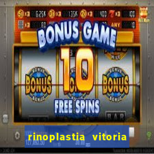 rinoplastia vitoria da conquista